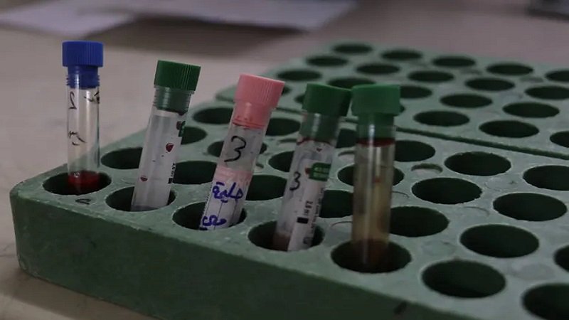 15 عاماً والقامشلي بلا بنك دم! 2 شسيشيشسيذط3 1759306034