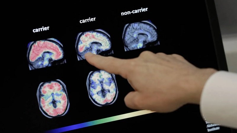 هوايات تنشط عقلك وتحافظ على شبابه... تعرف عليها 2 1297448