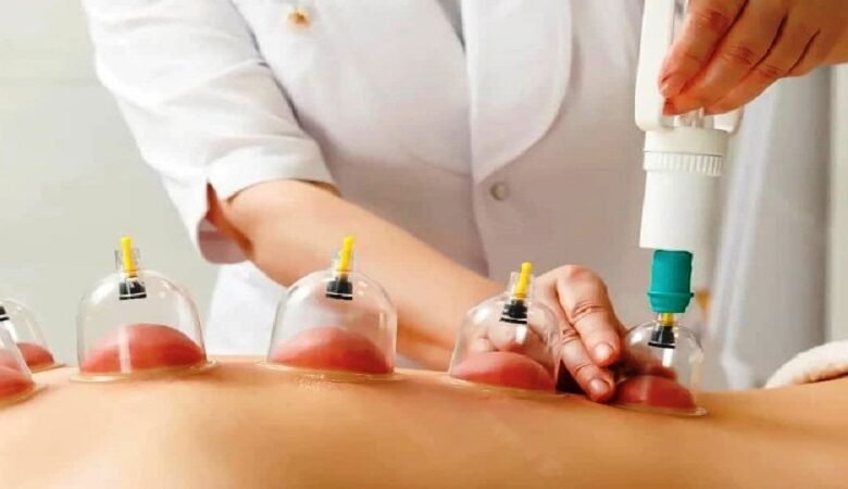الحجامة.. موروث شعبي يجدد طاقة الجسم ويعزز صحته 1 الحجامة.. موروث شعبي يجدد طاقة الجسم ويعزز صحته