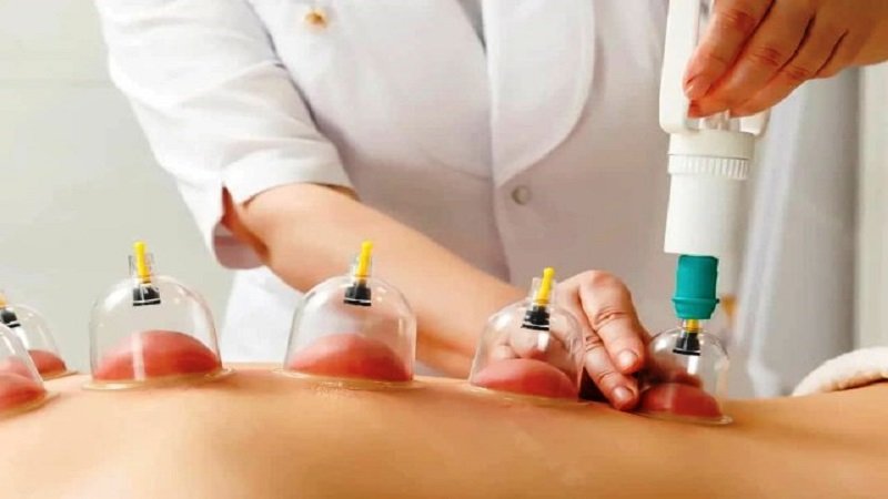 الحجامة.. موروث شعبي يجدد طاقة الجسم ويعزز صحته