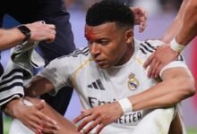 «آلام الغُرَز» تغيِّب مبابي عن تدريبات ريال مدريد 16 «آلام الغُرَز» تغيِّب مبابي عن تدريبات ريال مدريد