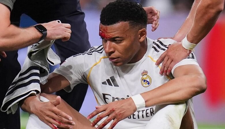 «آلام الغُرَز» تغيِّب مبابي عن تدريبات ريال مدريد
