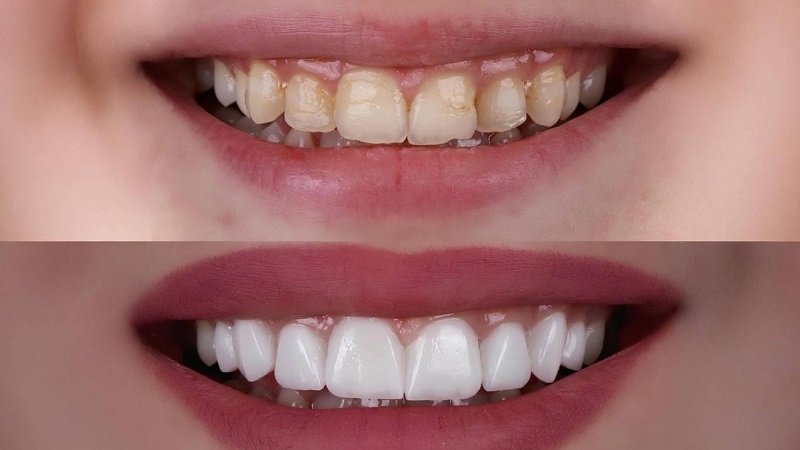 في 30 دقيقة فقط.. تقنية جديدة تُحدث ثورة في علاجات الأسنان 2 5146281