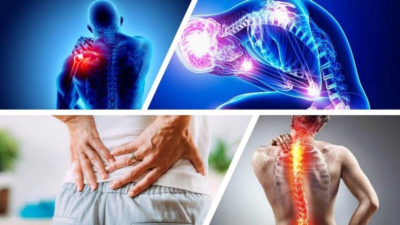 miyofasiyal agri fibromiyalji 1024x575 2