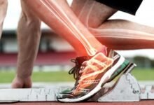 5 أطعمة تدعم صحة العظام