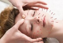 الوخز بالإبر علاج قديم.. لماذا لم يفقد مكانته؟ 2 الوخز بالإبر علاج قديم.. لماذا لم يفقد مكانته؟